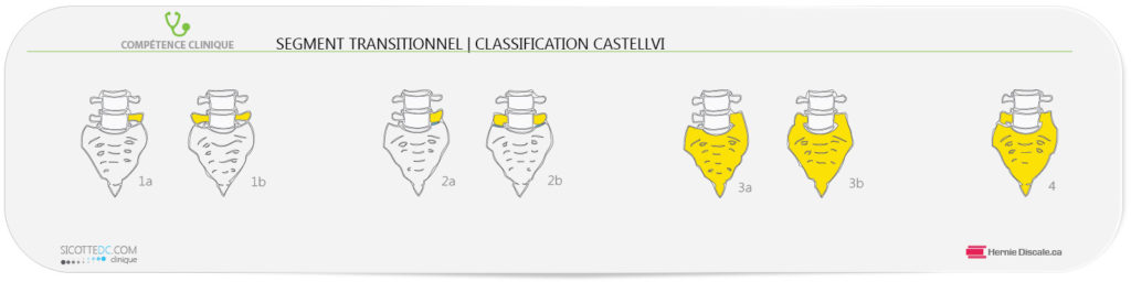 Les sept categories du segment transitionnel lombaire et le joint sacro-iliaque.