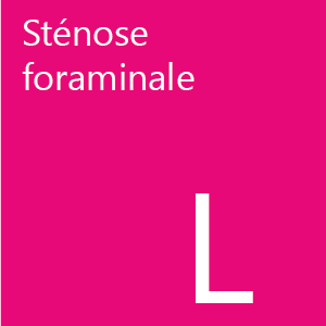 La sténose est un rétrécissement du foramen.
